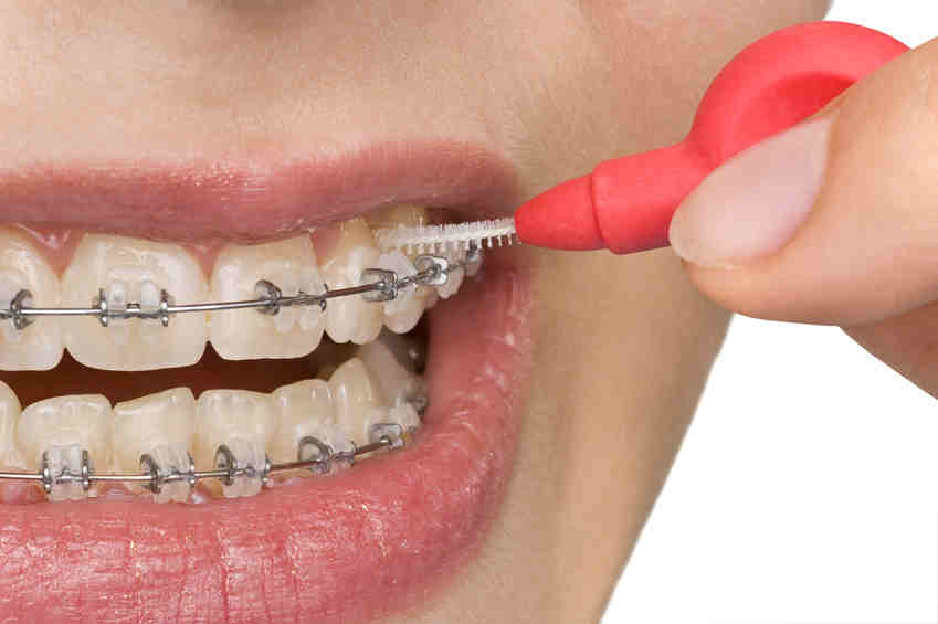 Ortodonta Toruń - leczenie wad zgryzu gabinet ortodontyczny